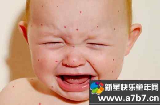 儿童有湿疹怎么办八款食疗赶走孩子的湿疹！