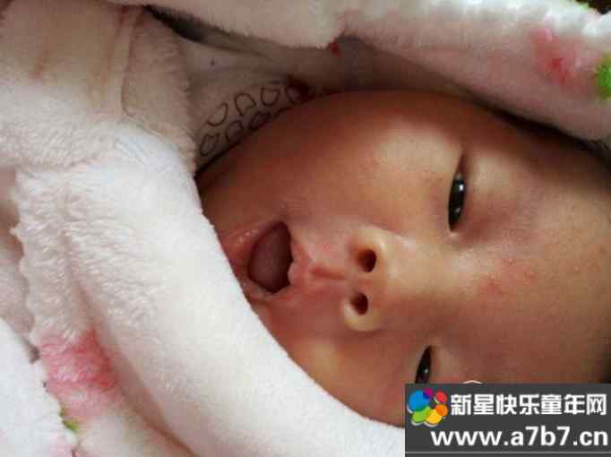 如何预防宝宝的湿疹复发？